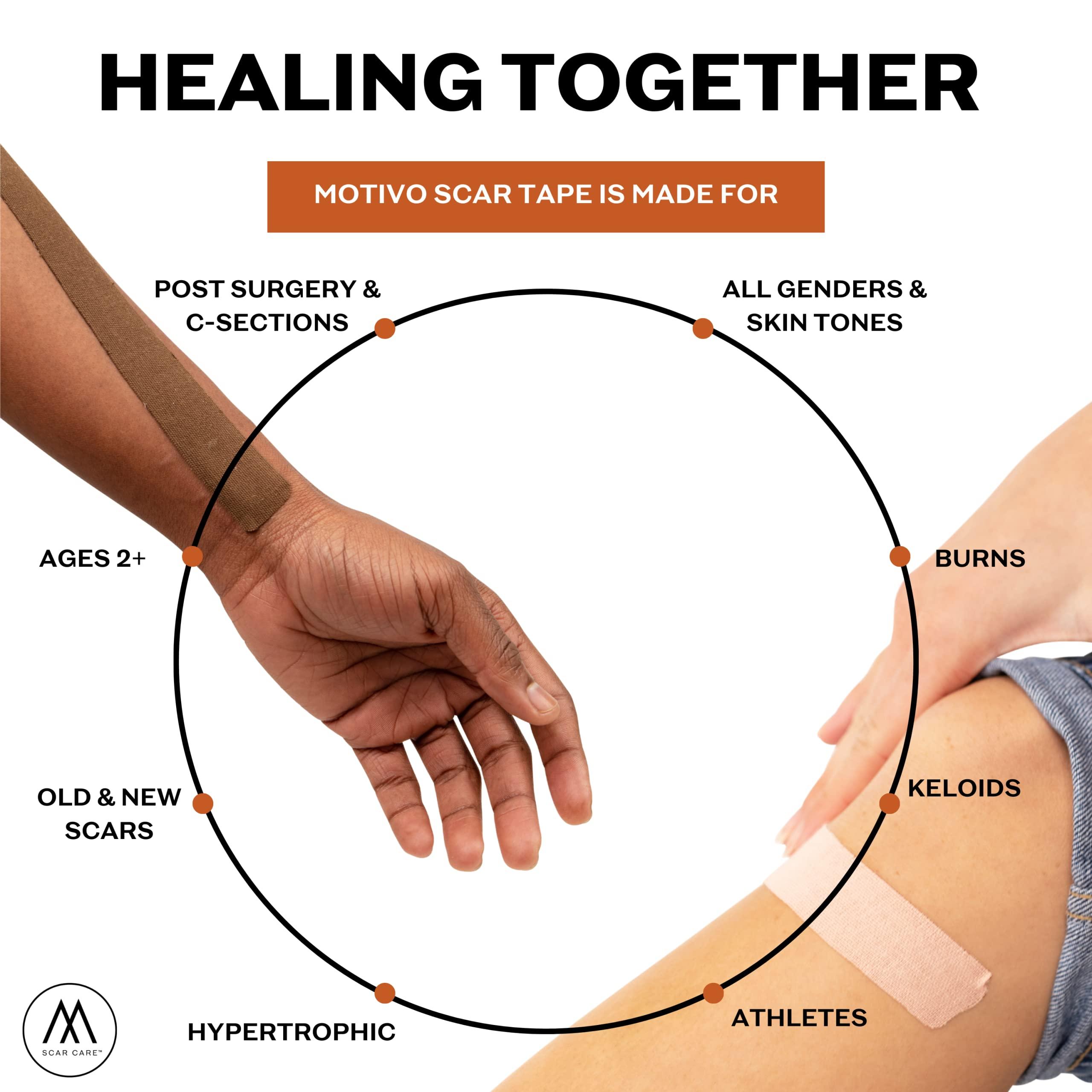 Motivo Scar Care Motivo Advanced Scar Care Bundle: Scar Tape & Roller Serum (10ml) | Water & Sweat Resistant, Long-Lasting, Suitable for All Skin Types | Ideal for Surgical, C-Section, Trauma, & Acne Scars | Espresso