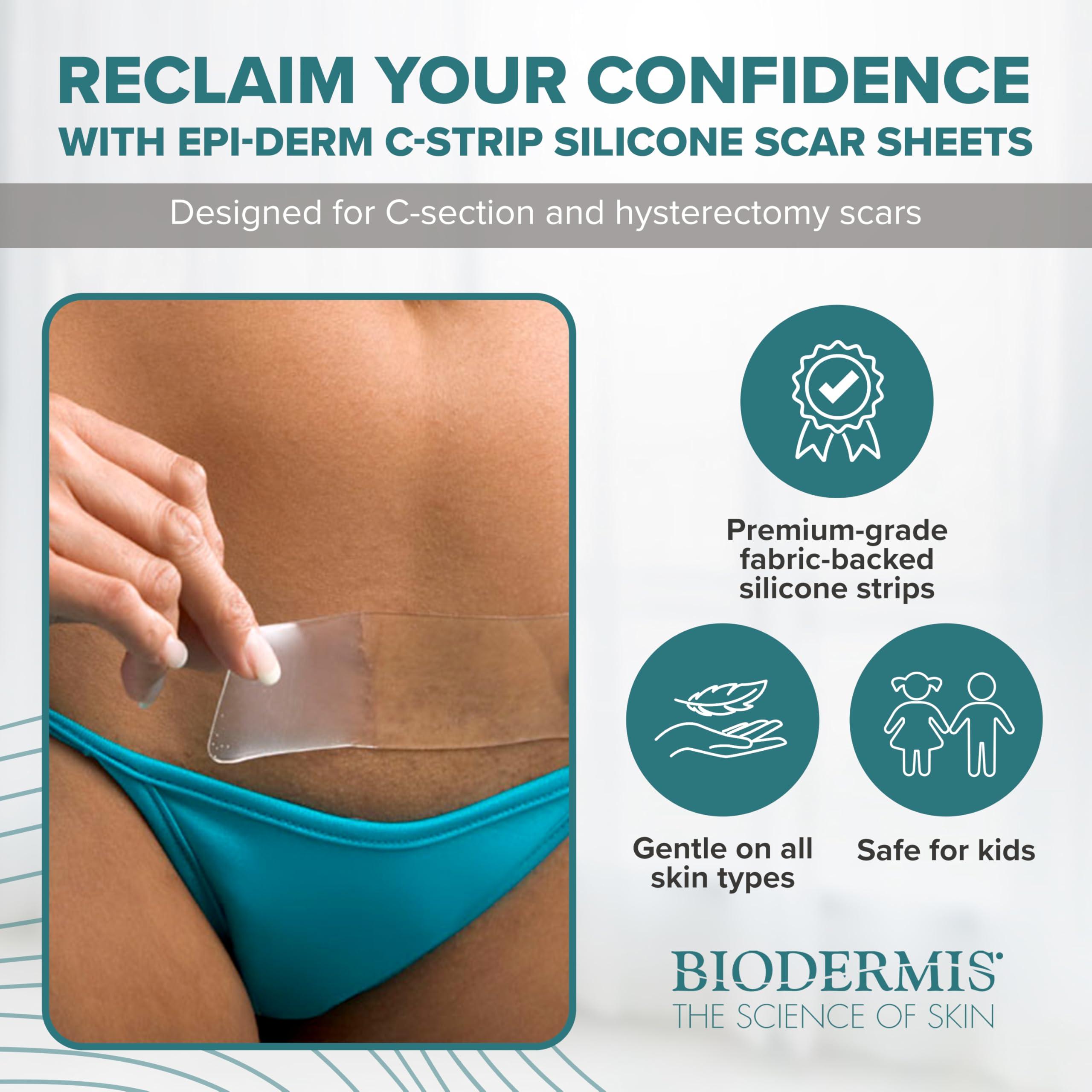 BIODERMIS EpiDerm Silicone Gel Scar Strips - Premium-Grade Silicone Scar Tape for Optimal Scar Care-Versatile, Flexible & Reusable - Ideal for C-Section, Tummy Tuck & Cardiac Surgery Scars - 1.4\"x6\", Clear