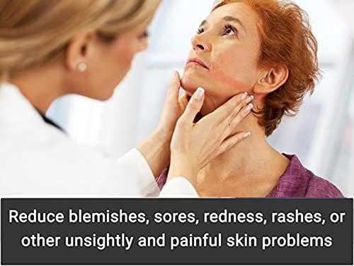 AVEEN AVEEN CPAP Neck Pad for CPAP Headgear Straps, CPAP Comfort Neck pad, CPAP Covers, Fleece CPAP mask Strap Cover