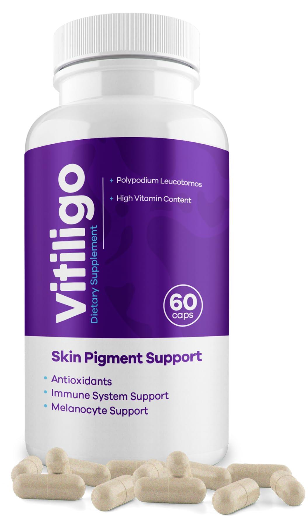 AURA VITAMINS AURA VITAMINS - Vitiligo Capsules 60 Count | 1 Month | Improve Skin Pigmentation Support and Reduce White Spots | Effective Vitiligo Supplement | Natural Solution for White Spots on Skin. (1)