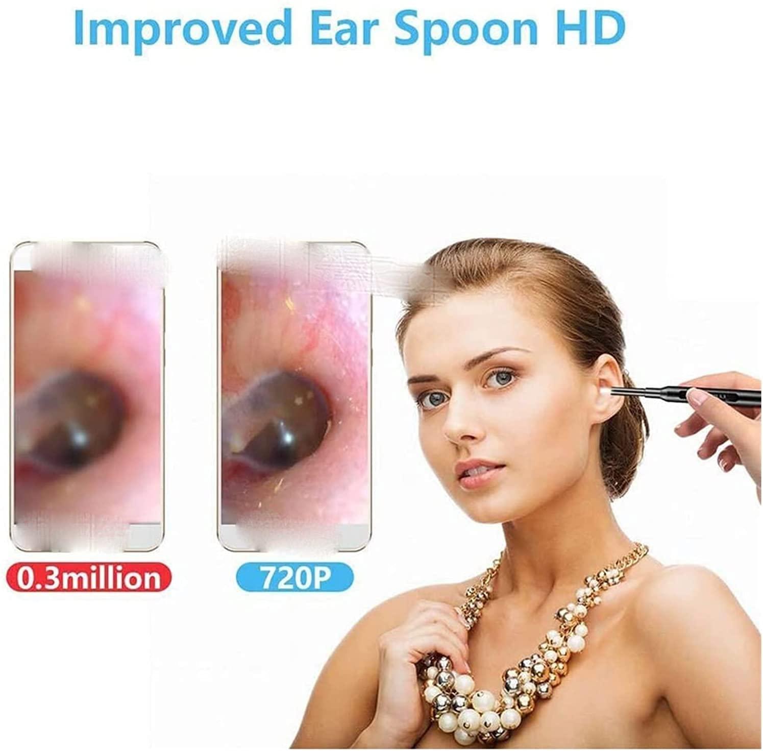 SMSOM SMSOM Ear Wax Removal Tool with Camera,Ear Wax Cleaner Tools with 1080P HD Ear Otoscope,Earwax Cleaner Pick Kit (Black)