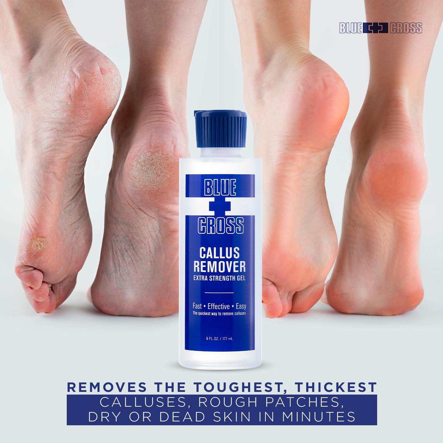 Blue Cross Blue Cross Callus Remover Gel for Feet or Heel, Extra Strength Professional Nail Care, File, Shaver, Scrubber & Pumice Stone Alternative for at Home Manicure/Pedicure Results, 6oz
