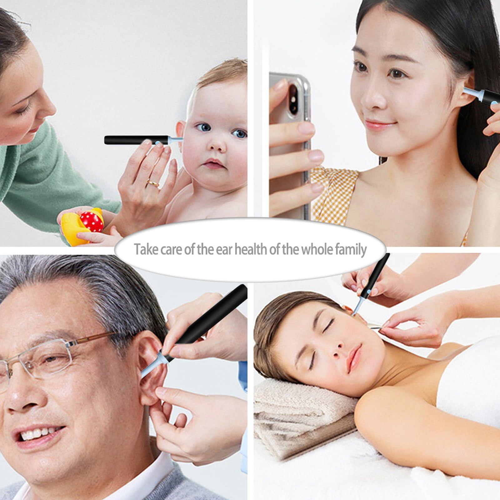 mcgotasy Earify Ear Wax Removal, Fluffora Ear Cleaner, Fluffora Pro Ear Cleaner, Astroridge Ear Cleaner, Rechargeable Ear Wax Removal Tool with Camera (2 Colors)