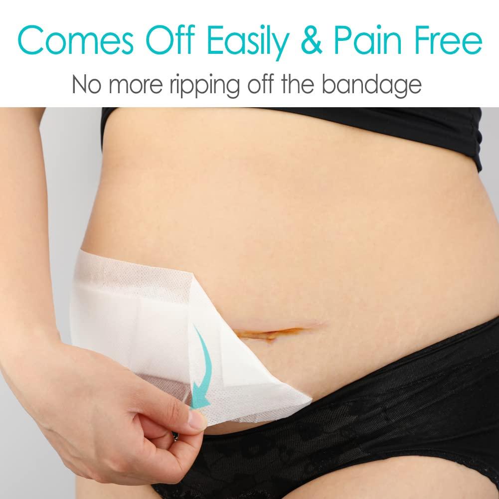 POSTOP MEDICAL WEAR 20 Pcs Waterproof C-Section Adhesive Island Dressing Long | 4x12 Inch Tummy Tuck Incision Long Post Surgery Bordered Gauze Bandage + Absorbent Dressing Pad Sterile Large Wound Recovery
