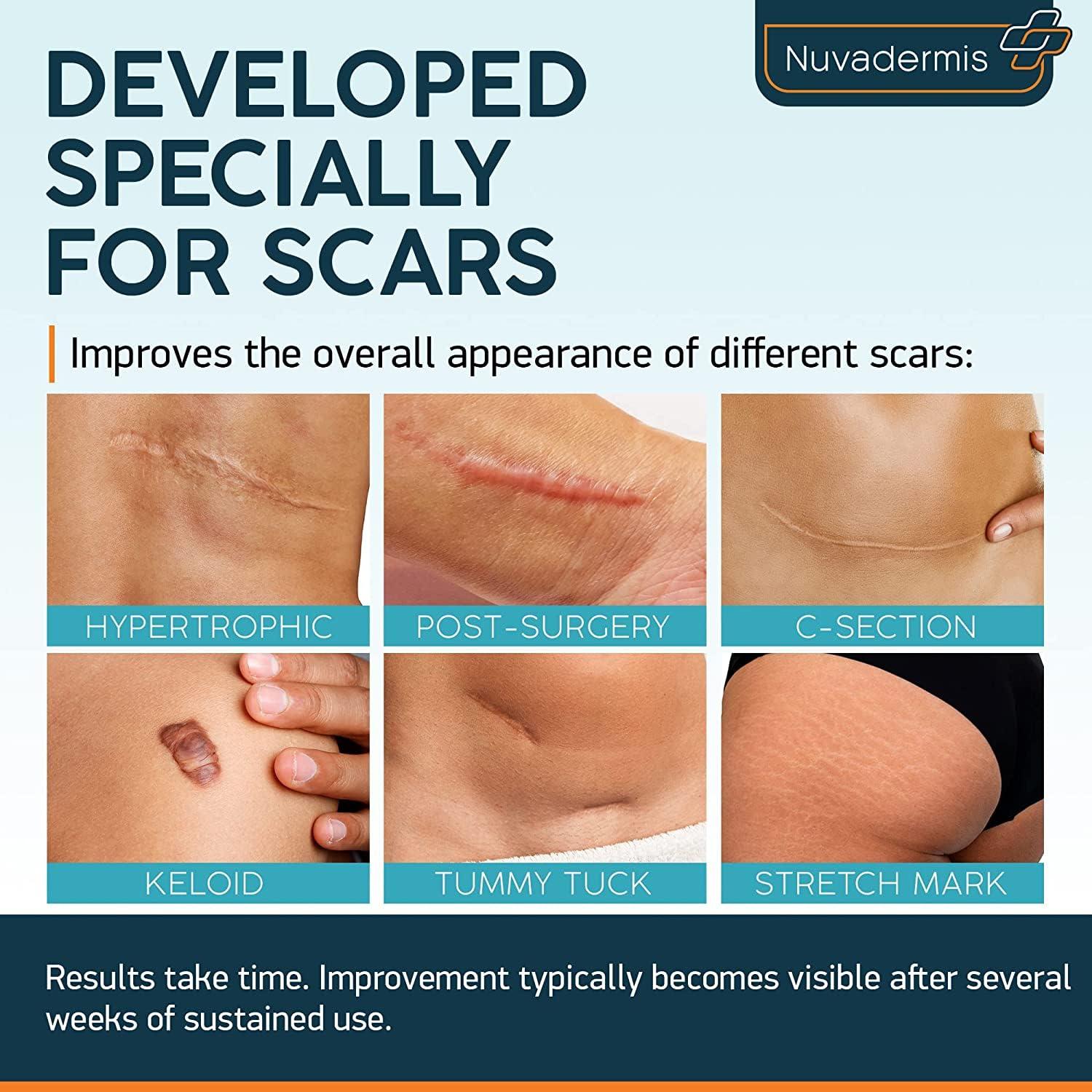 NUVADERMIS Nuvadermis Scar Care Bundle - Advanced Scar Gel 2 Pk & Silicone Scar Tape 1 Pk
