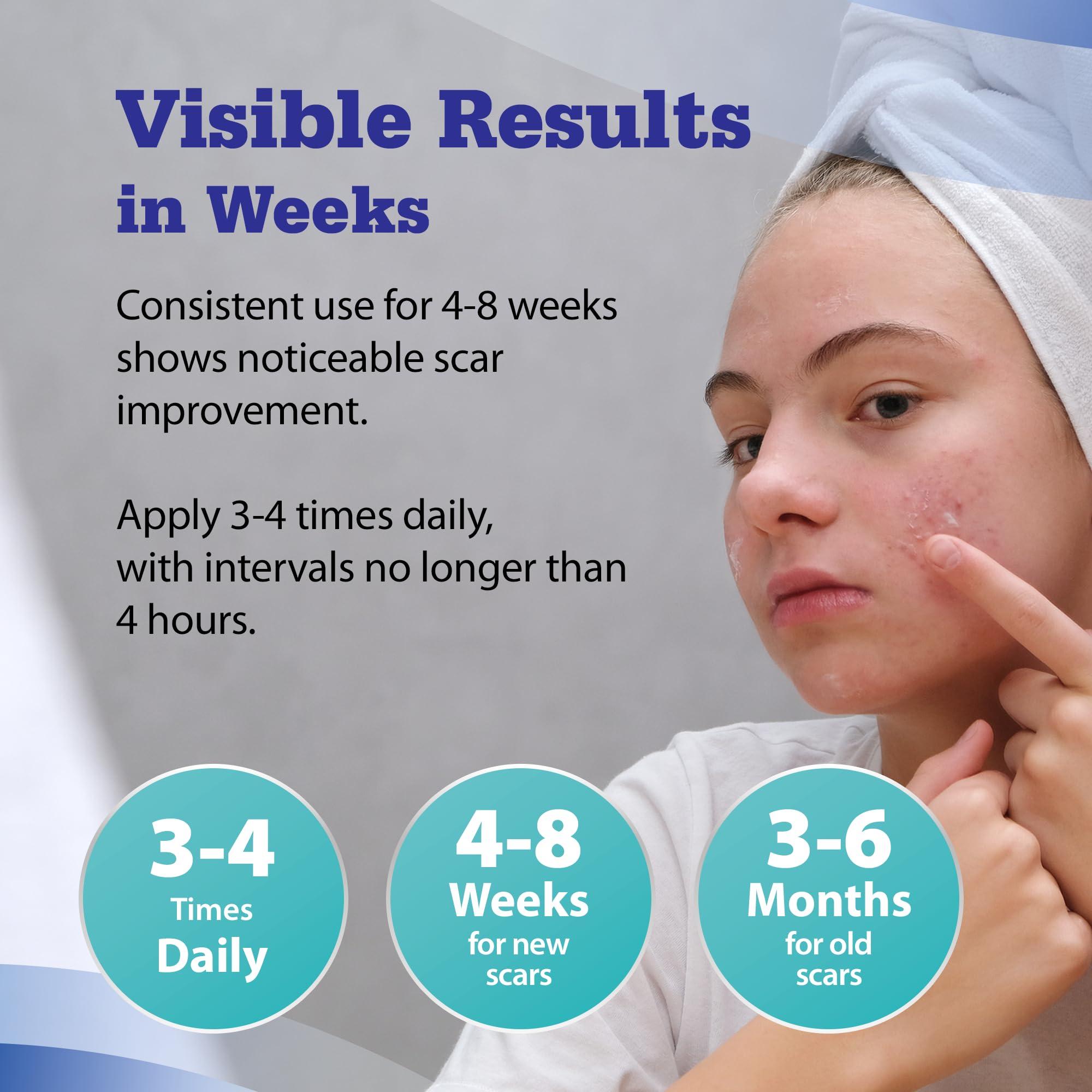 Aroamas Scar Aroamas Scar Advanced Scar Gel - Medical-Grade Silicone Scar Gel for Surgical Scars, for Face, Scar gel with silicone for Keloids, C-Section, Cosmetic Procedures, Burns, Injuries - 45g