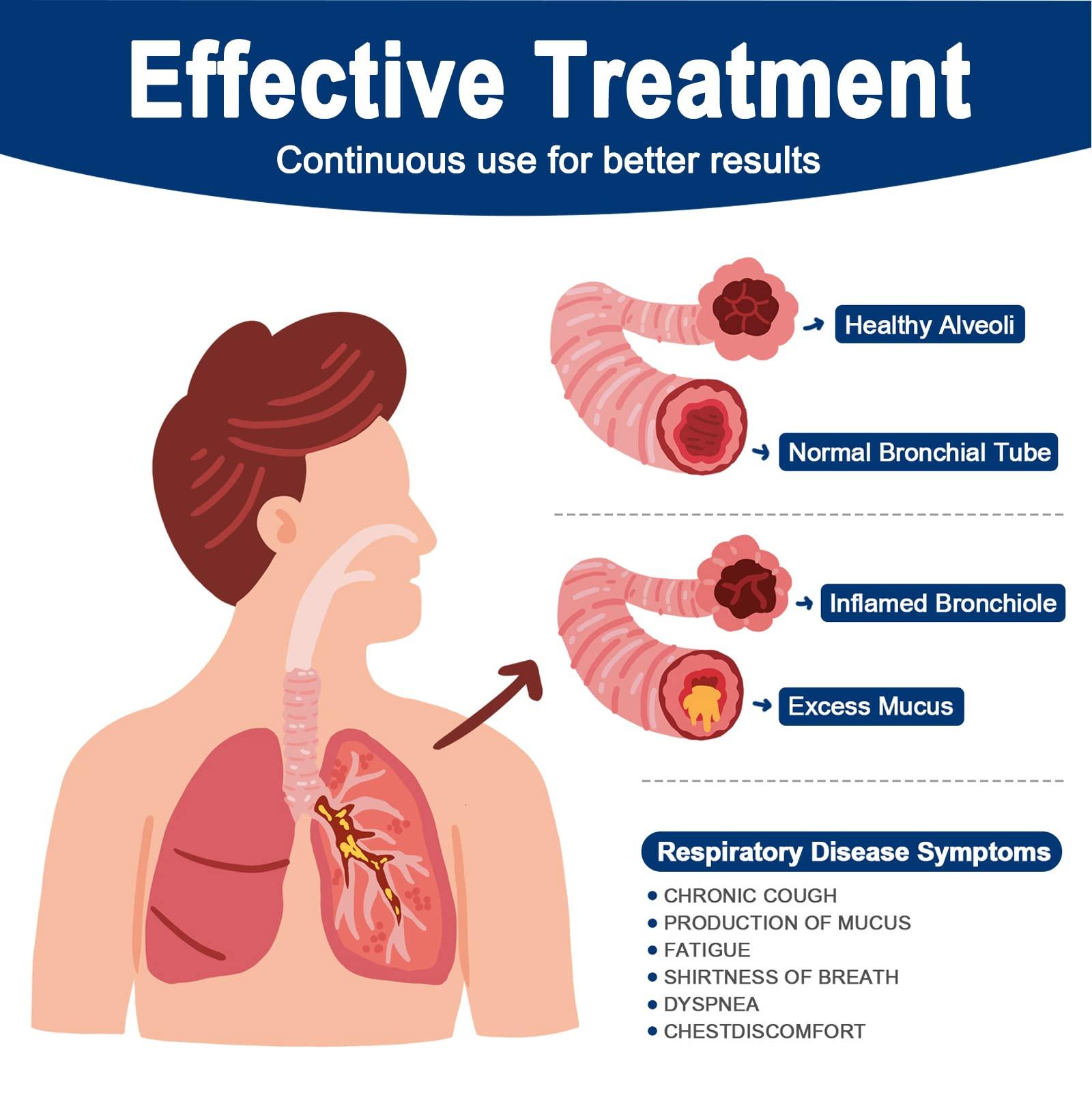 NebuAksol Lung Exerciser Device, Breathing Exercise Device for Lungs, Valve Mucus Removal Device, Mucus Clearance and Lung Expansion Device