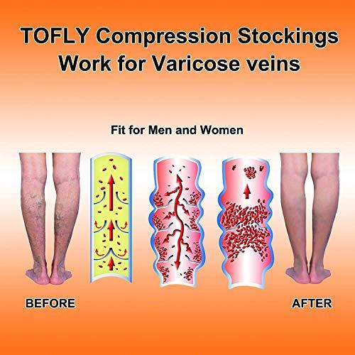 TOFLY TOFLY® Calf Compression Sleeve for Men & Women, 1 Pair, Footless Compression Socks 20-30mmHg for Leg Support, Shin Splint, Pain Relief, Swelling, Varicose Veins, Maternity, Nursing, Travel, Beige 5XL