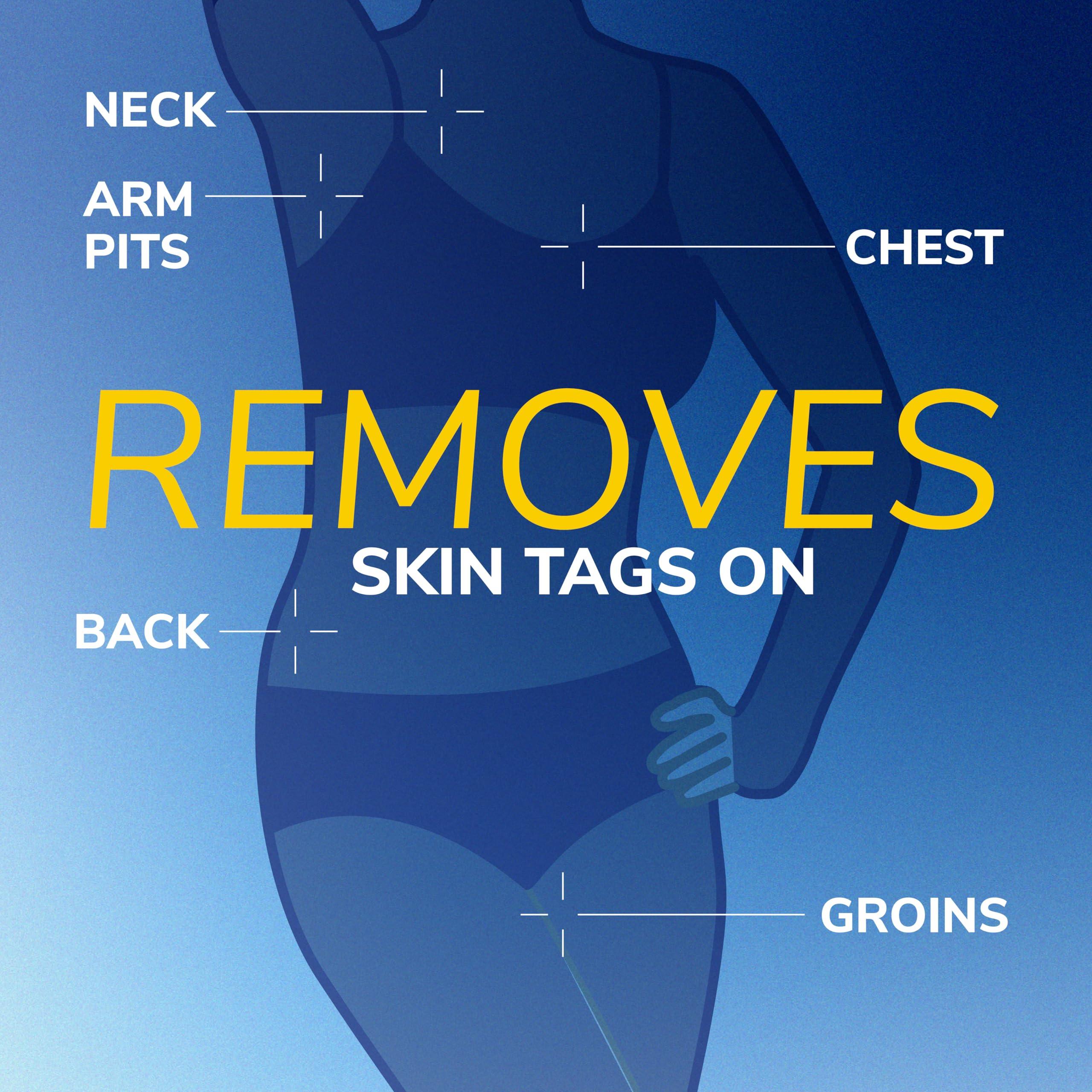 Dr. Scholl's Dr. Scholl's Freeze Away Skin Tag Remover - The First FDA Cleared, at Home Skin tag Removal kit. Clinically Proven Skin tag Removal in as Little as 1 Treatment. 1 Skin tag Removal kit, 8 Treatments.