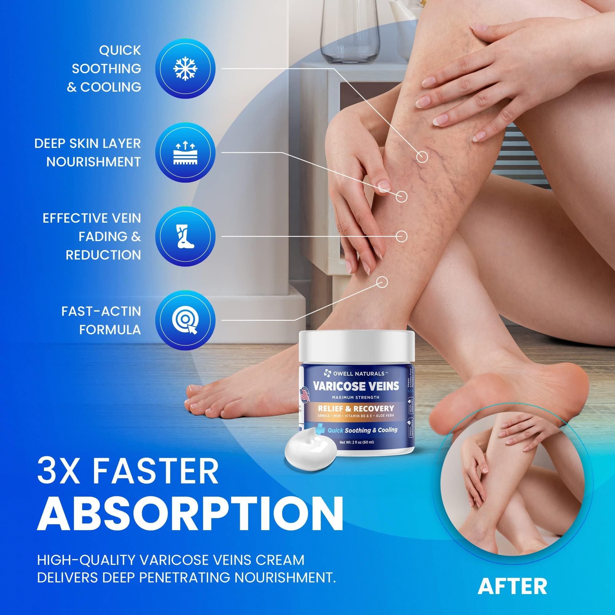 OWELL NATURALS OWELL NATURALS Varicose & Spider Vein Leg Cream 2oz - Maximum Strength All Natural Formula, Fast Acting Discomfort Reliever for Joint, Muscle, Knee (Pack of 2)