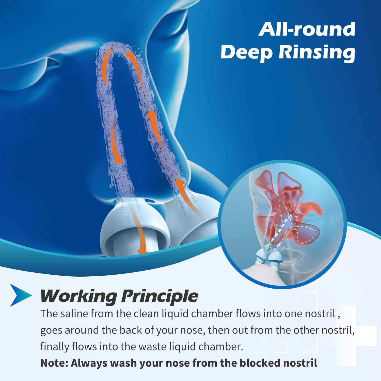Sonmol Sonmol Electric Nasal Irrigation System with 50 Salt Packets Nose Wash Deep Cleaning Sinus Rinse Relieve Congestion Runny Nose Itching