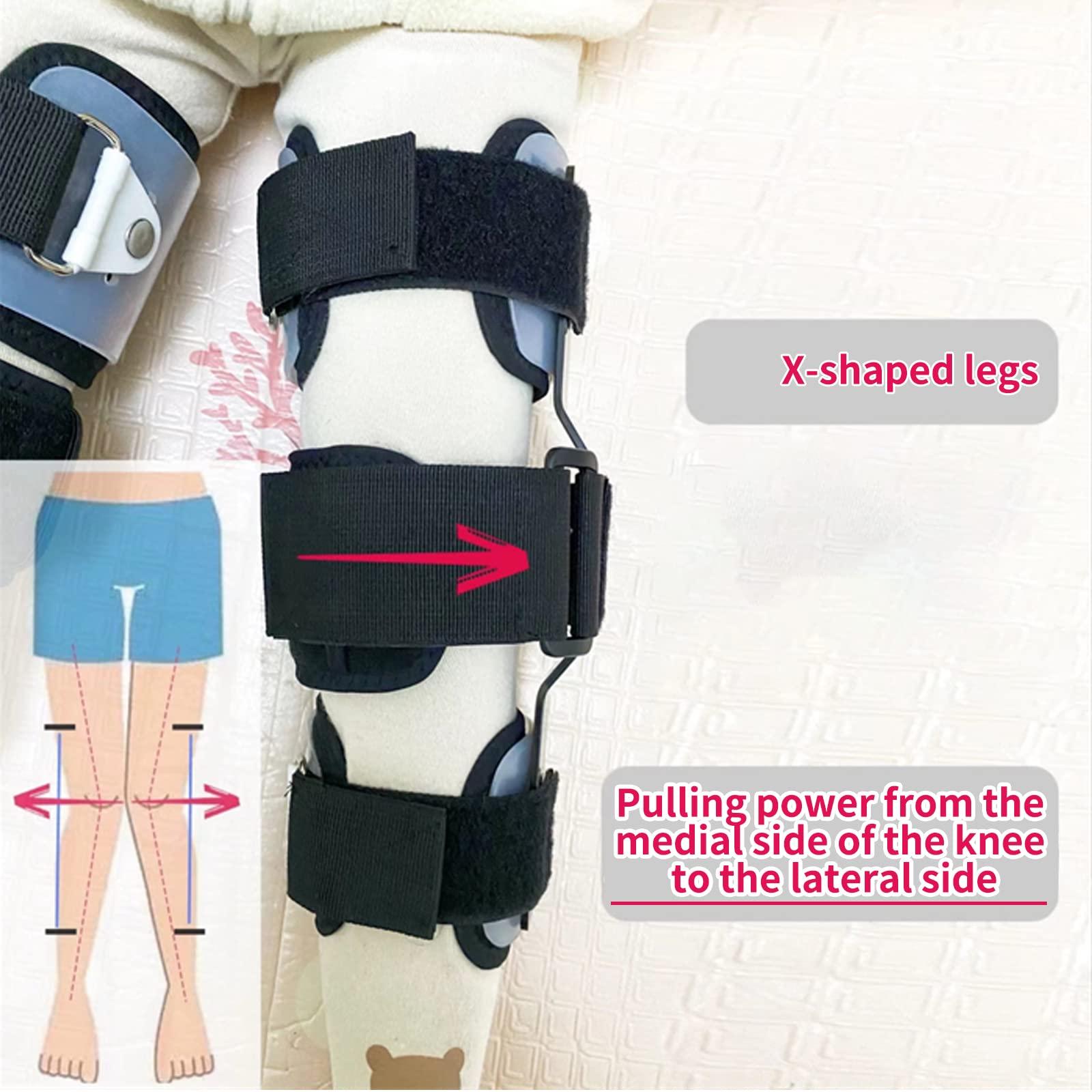 Shuyan Jiao Shuyan Jiao O/X Leg Type Correction Belt Pediatric Kids Leg Posture Corrector Brace for Children Knees Valgus Straighten Belt Lightweight Medical O/X Legs Type Bandage (M -1 Pair)
