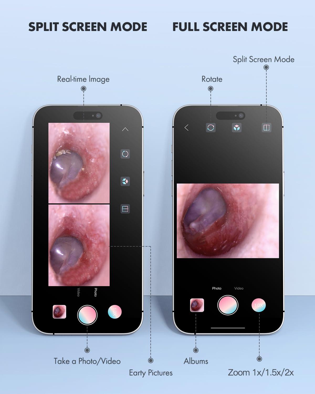 Anykit Anykit Digital Otoscope for Phone & Tablet, Ultra Clear View Ear Camera with Ear Wax Removal Tools, Video Ear Scope Otoscope with Light, Support Capture Photo & Record Videos