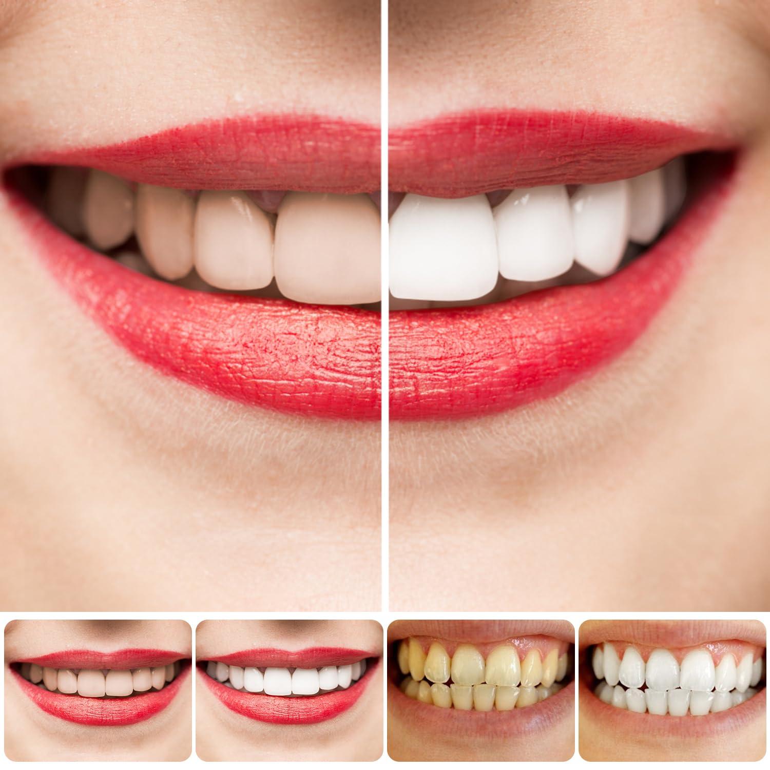 Rednow Sp-4 Toothpaste,Sp-4 Probiotic Whitening Toothpaste,Fresh Breath Toothpaste Brightening & Stain Removing Toothpaste (3Pcs with 2* Toothbrush)