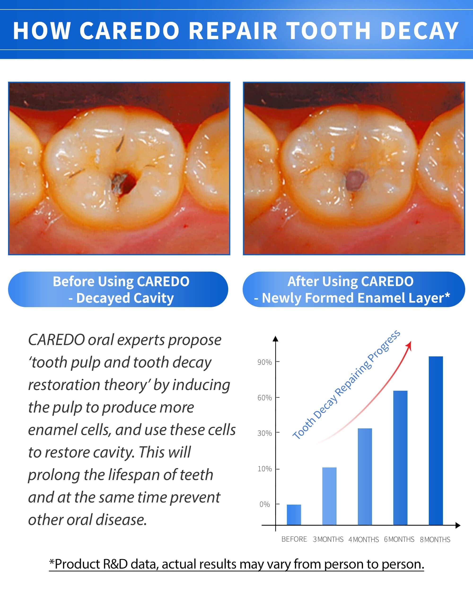 CAREDO CAREDO Cavity Repair Toothpaste Set for Adults, 16g Pulpitis Ointment for Tooth Decay Pain & 100g Hydroxyapatite Toothpaste for Home Cavity Repair, Fluoride Free