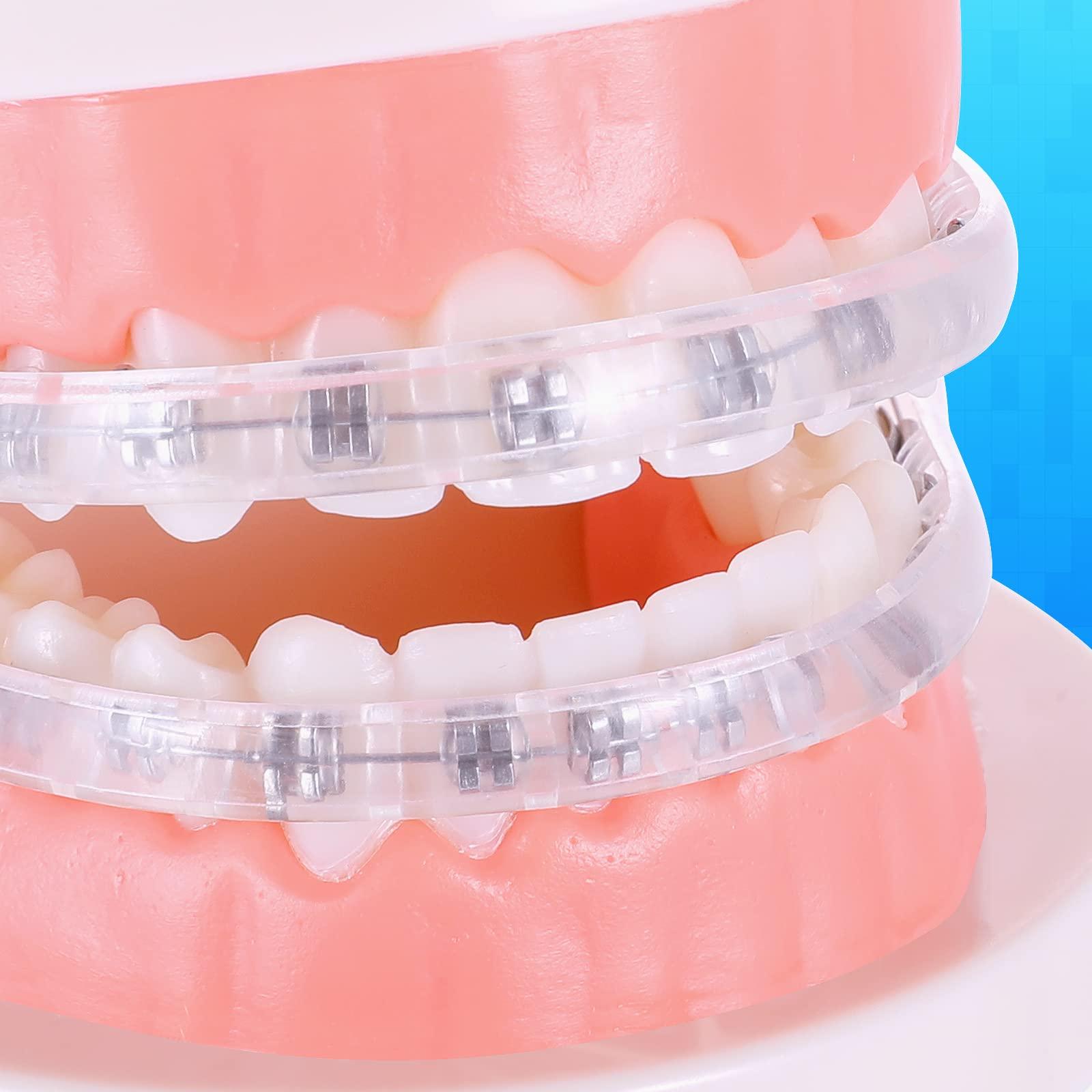 OBrush Obrush Comfort Covers for Braces - Orthodontic Mouth Guard, Lip Protector, Wax Alternative, Lip Shield for Brackets