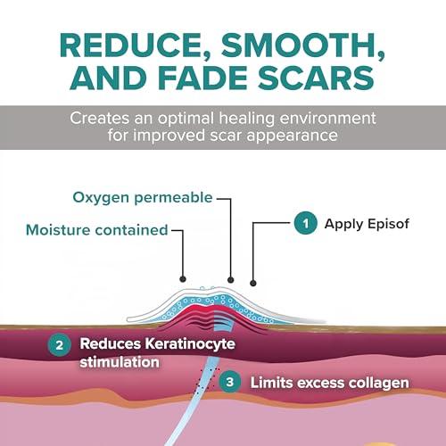 BIODERMIS Biodermis Episof Silicone Scar Gel Pump, Premium Grade Skin Repair Silicone Gel for Scars, Stretch Marks, Fine Lines & Wrinkles - Advanced Scar Care, Fast-Drying, Non-Oily, Scar Cream Post Surgery