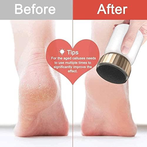 Feilx Feilx Electric Feet Callus Removers Rechargeable, Electronic Foot File Callus Remover, Professional Pedicure Tools, Portable Foot Grinder Foot Care Tool for Dead Skin,Hard Cracked Dry Skin Ideal Gift