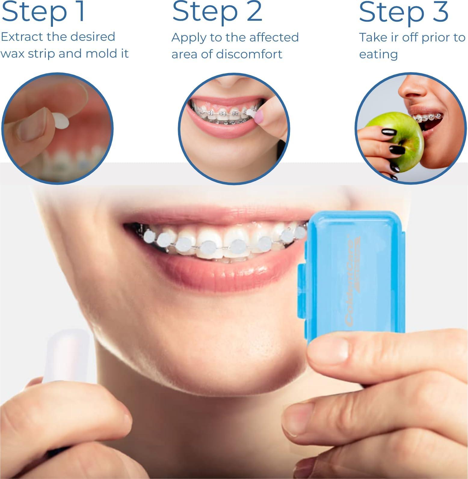 ColdentCare Orthodontic Braces Wax, 60 premium wax strips ColdentCare - Dental Wax for Braces and Aligners Wax Strips, Multicolor cases, 12 Pack with storage case, Light Mint Scent.