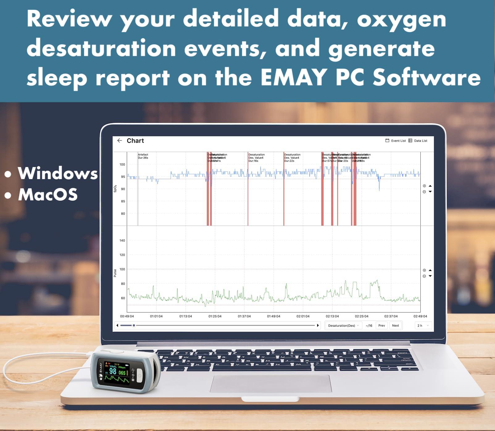 EMAY EMAY Sleep Oxygen Monitor with PC Software & App | Bluetooth Pulse Oximeter Rechargeable for Overnight & Continuous SpO2 Tracking with 72 Hours Built-in Memory | Gives Informative Report & Analysis
