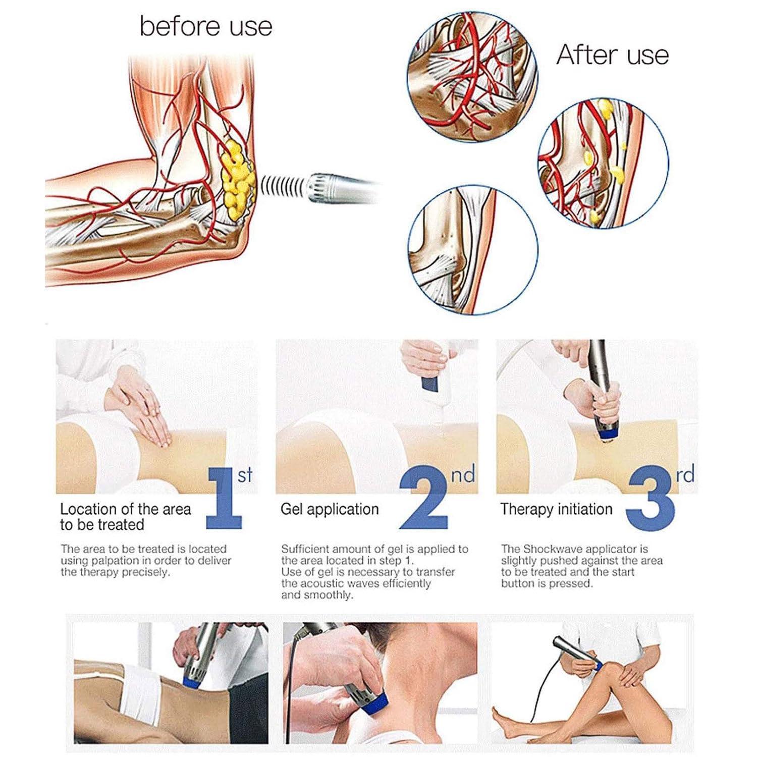 DAZULI DAZULI Shockwave Therapy Machine, Effective Electromagnetic Extracorporeal E-D Shock Wave Therapy Machine Pain Relief Body Massager Muscle Relax Massage Gun with 7 Massage Heads,220V