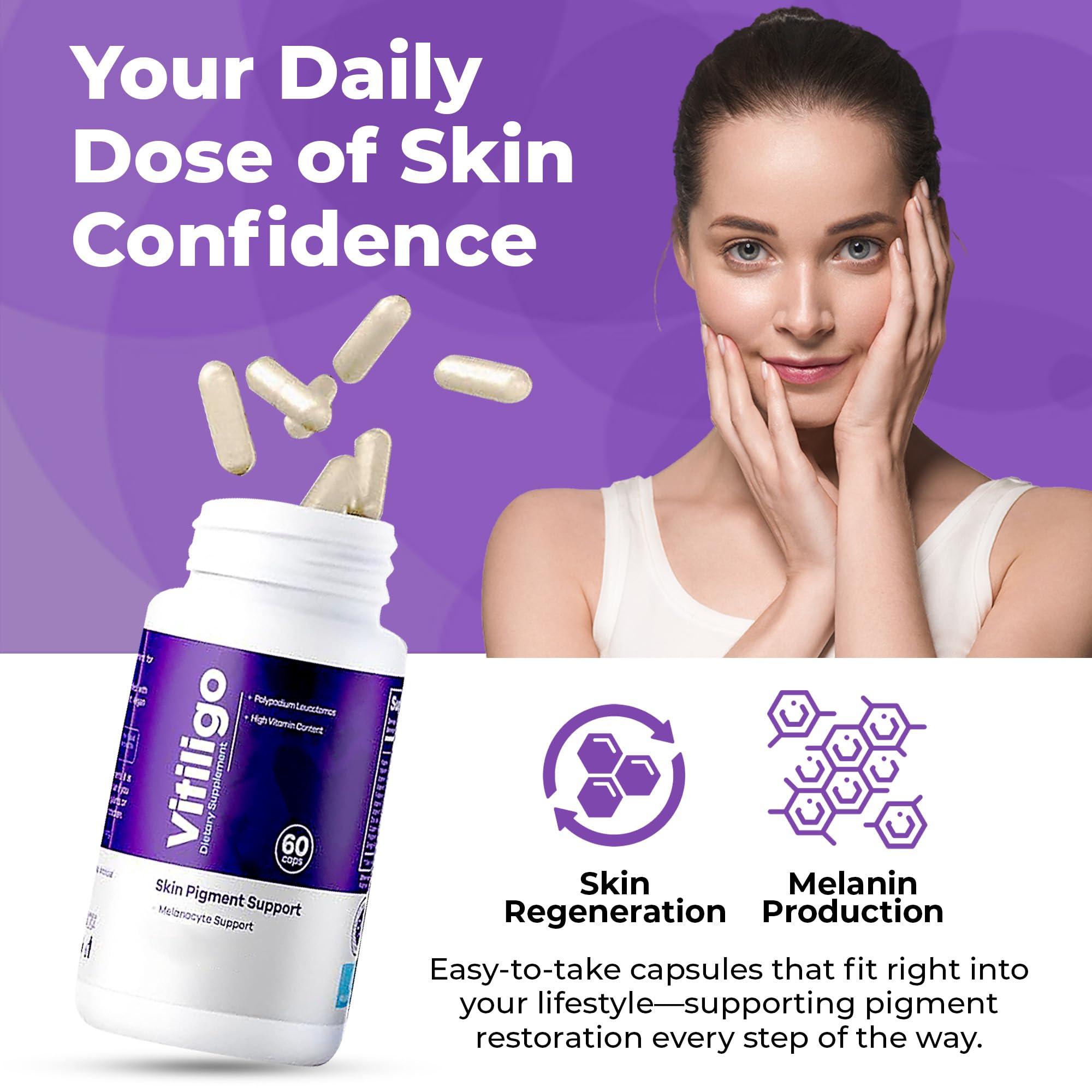 AURA VITAMINS AURA VITAMINS - Vitiligo Capsules 60 Count | 1 Month | Improve Skin Pigmentation Support and Reduce White Spots | Effective Vitiligo Supplement | Natural Solution for White Spots on Skin. (1)