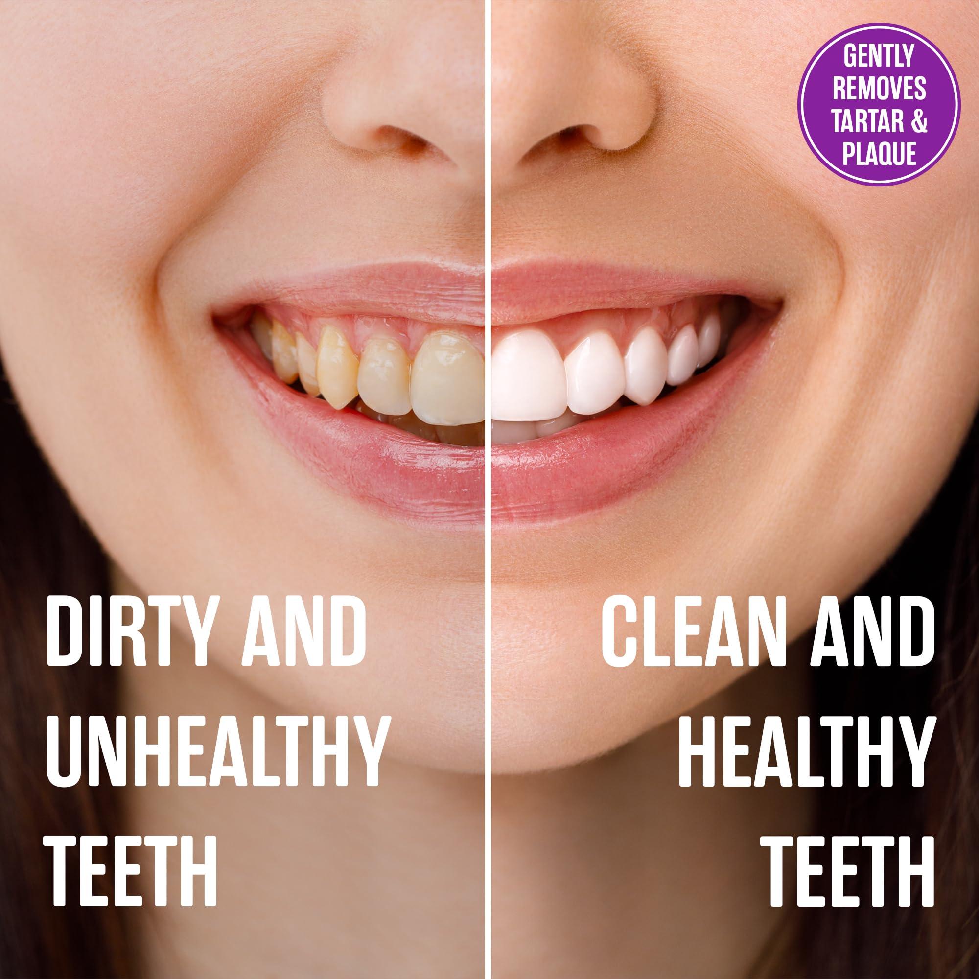 SprinJene SprinJene Natural Sensitivity & Gum, Fluoride Toothpaste for Sensitive Teeth | Natural Toothpaste for Cavity Protection | 1 Pack