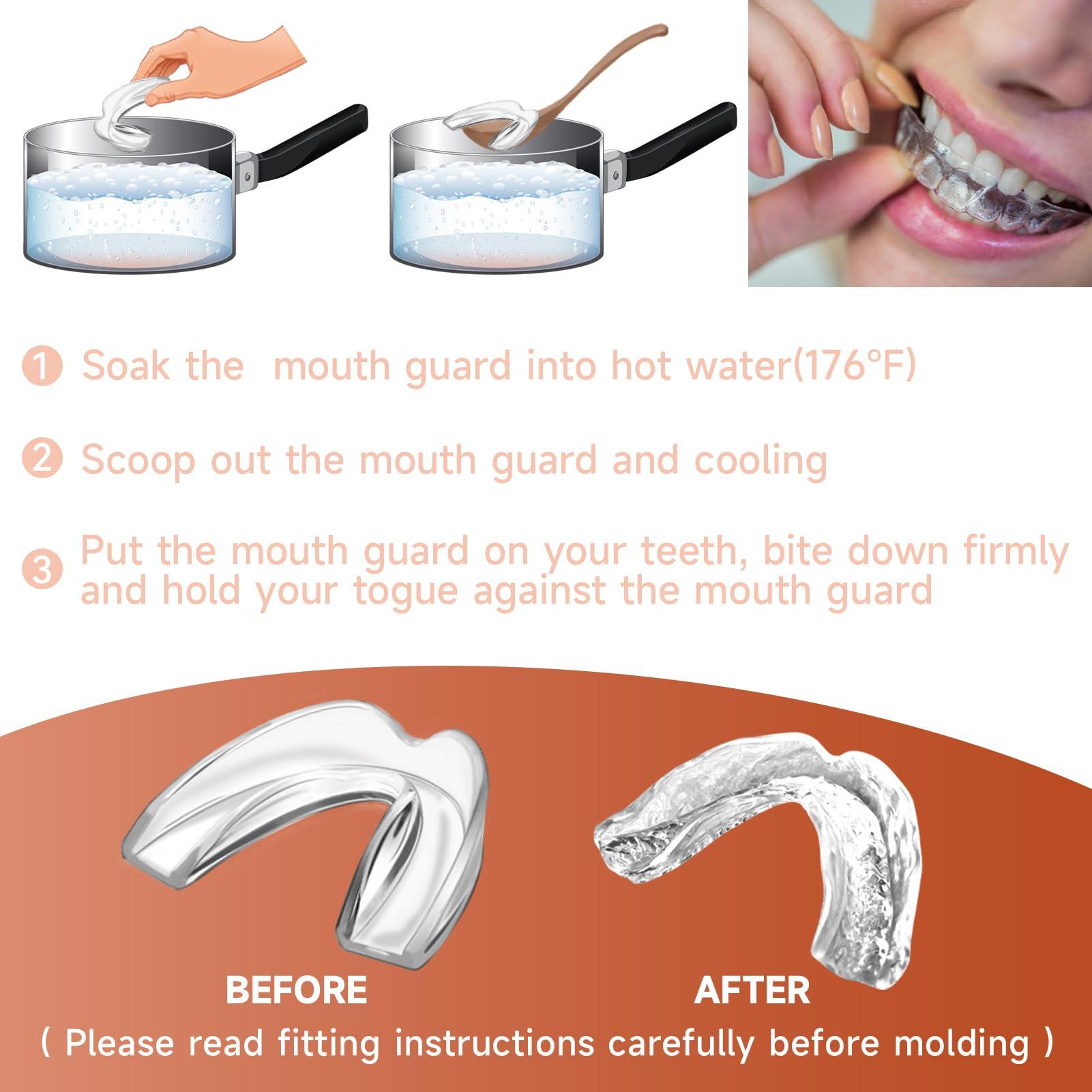 Mictaning 4 Pack Orange Kids Mouth Guard for Teeth Grinding,Comfortable Kids Night Guard,Moldable Child Bite Guard for Clenching Teeth, Mouthguard for Kids