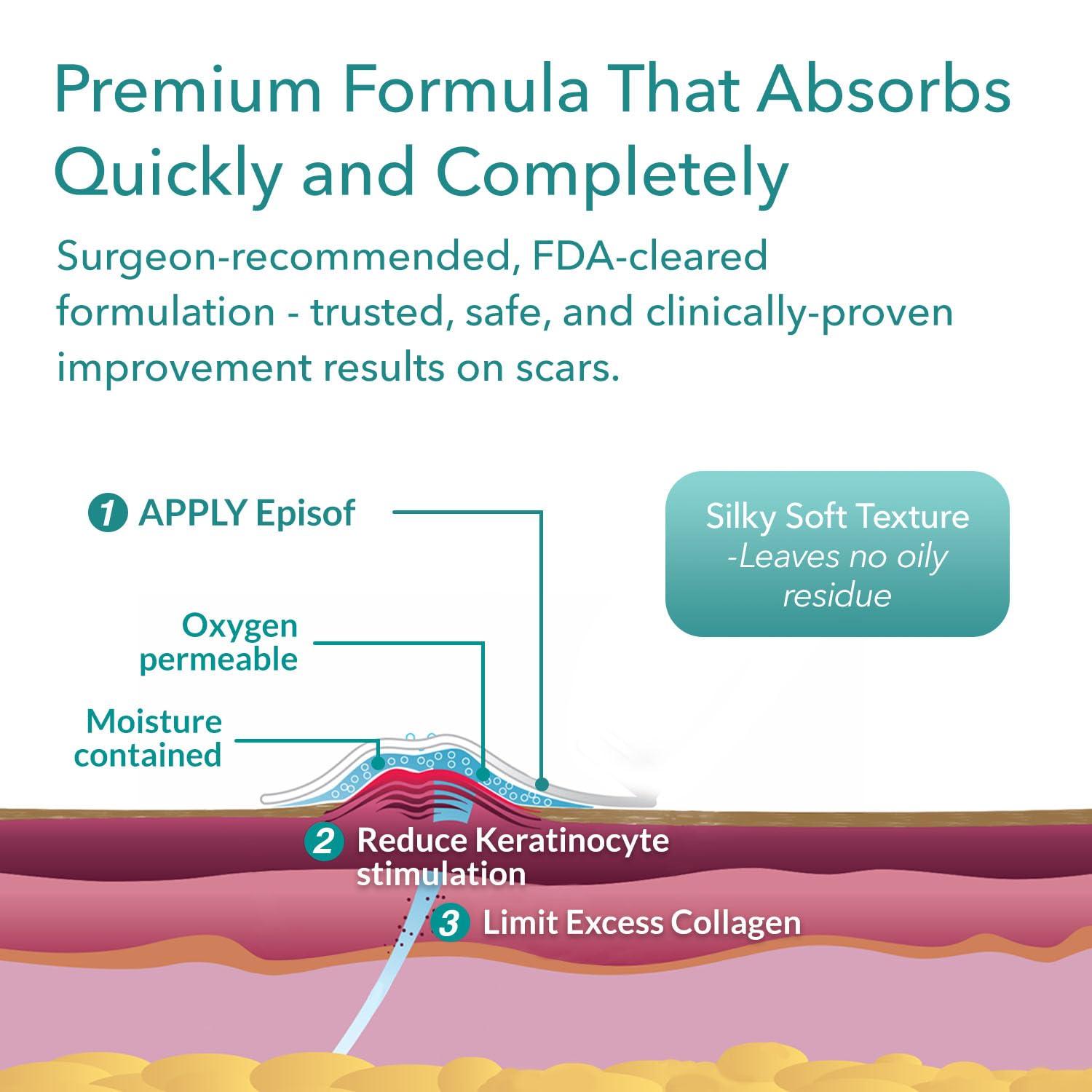 BIODERMIS Biodermis Episof Silicone Scar Gel Pump, Premium Grade Skin Repair Silicone Gel for Scars, Stretch Marks, Fine Lines & Wrinkles - Advanced Scar Care, Fast-Drying, Non-Oily, Scar Cream Post Surgery