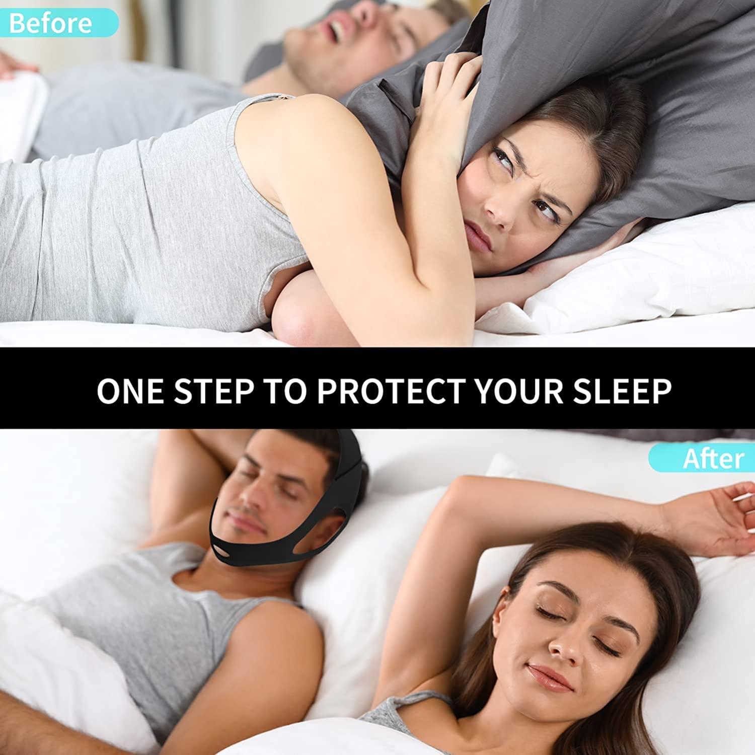 Babyfond Anti Snoring Chin Strap for Men and Women, Comfortable Chin Strap for Cpap Users, Adjustable Stop Snoring Chin Strap Snoring Solution Chin Straps to Keep Mouth Closed While Sleeping (Black)