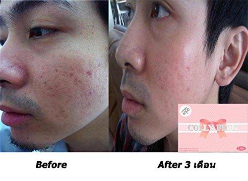 Colly Pink Colly Pink Plus Collagen 10000mg Dietary Drink Strawberry Fish Collagen Peptide