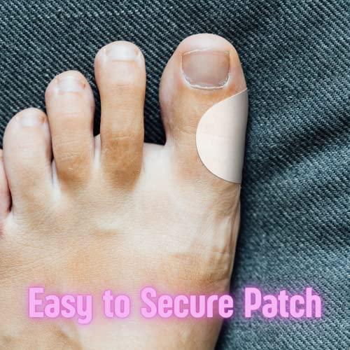 Medagel Medagel Protective Adhesive Knit Medical Tape to Secure Hydrogel Pads & Hexagels for Blisters, Bites, Burns, Cuts & Wounds, Lightweight & Breathable, 1.5\" Circles, 200 Count