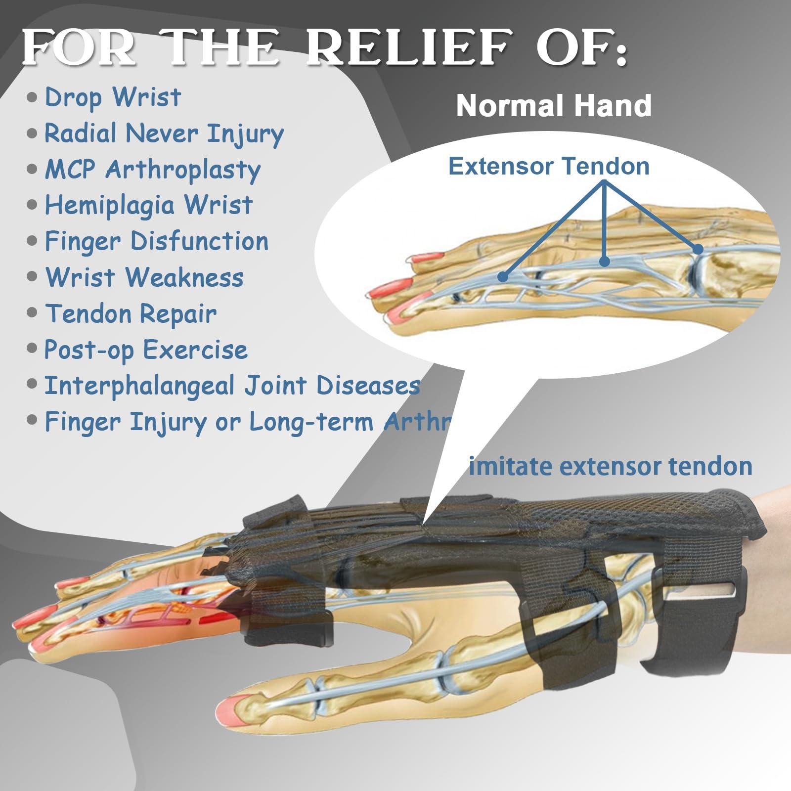 Feamero Feamero Radial Nerve Palsy Splint, Adjustable Finger Extension Brace, Lift Elastic Splint for Drop Wrist, Radial Nerve Injury, Mcp Arthroplasty, Crutch Palsy Treatment, Fit Left & Right Hand