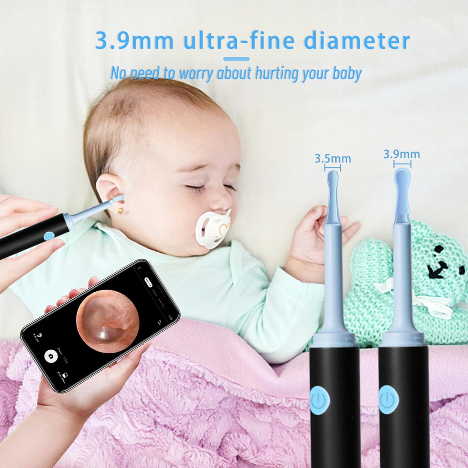 mcgotasy Earify Ear Wax Removal, Fluffora Ear Cleaner, Fluffora Pro Ear Cleaner, Astroridge Ear Cleaner, Rechargeable Ear Wax Removal Tool with Camera (Black)