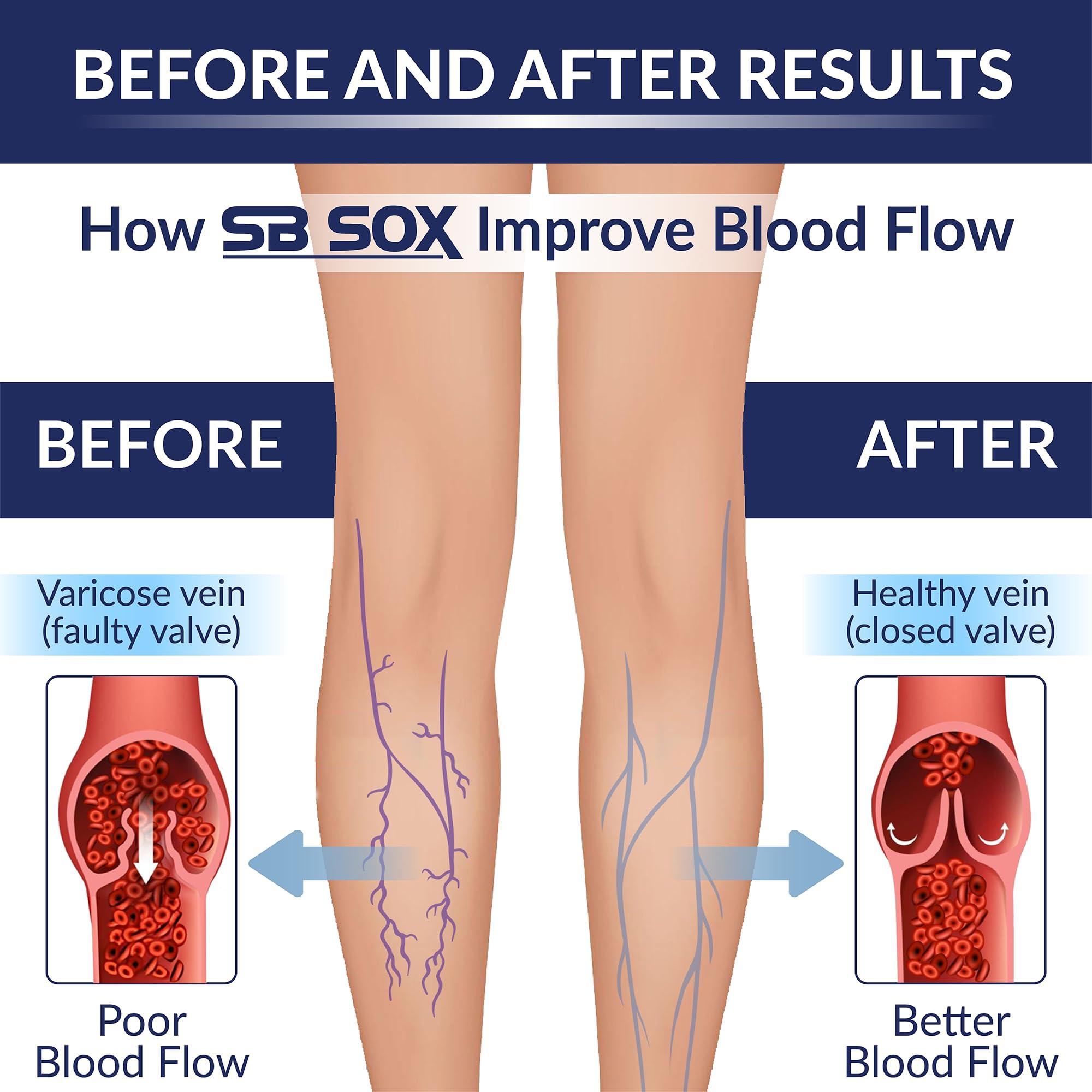 SB SOX SB SOX Compression Socks (20-30mmHg) for Men & Women – Best Compression Socks for All Day Wear, Better Blood Flow, Swelling! (Large, Black/Blue)