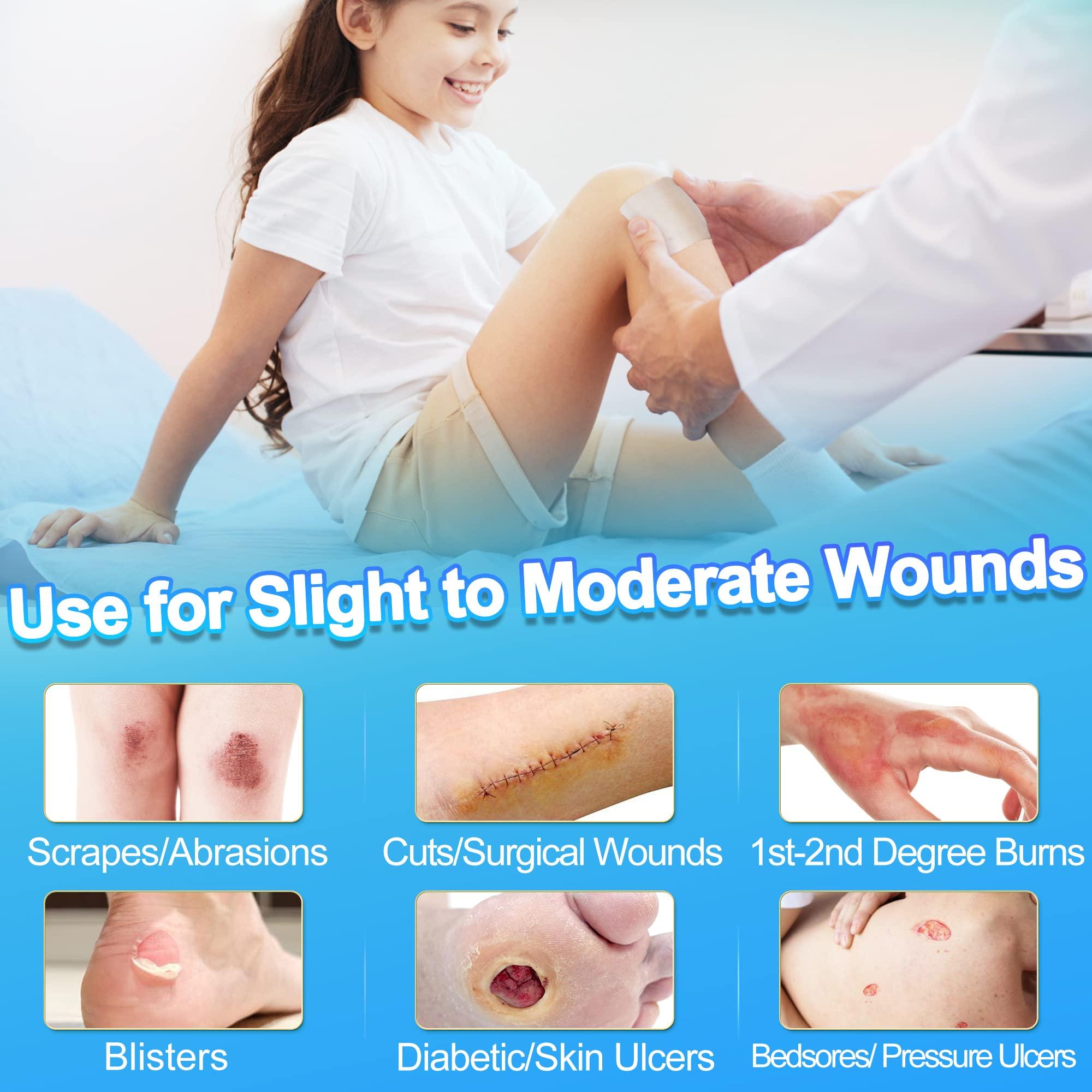 LotFancy LotFancy Hydrocolloid Bandages, 4x4, 14 Patches, Ultra Thin, FSA HSA Eligible, Large Hydrocolloid Dressing, Waterproof Wound Care Dressing Pad for Blister, Bed Sore, Burn, Pressure Ulcer Healing