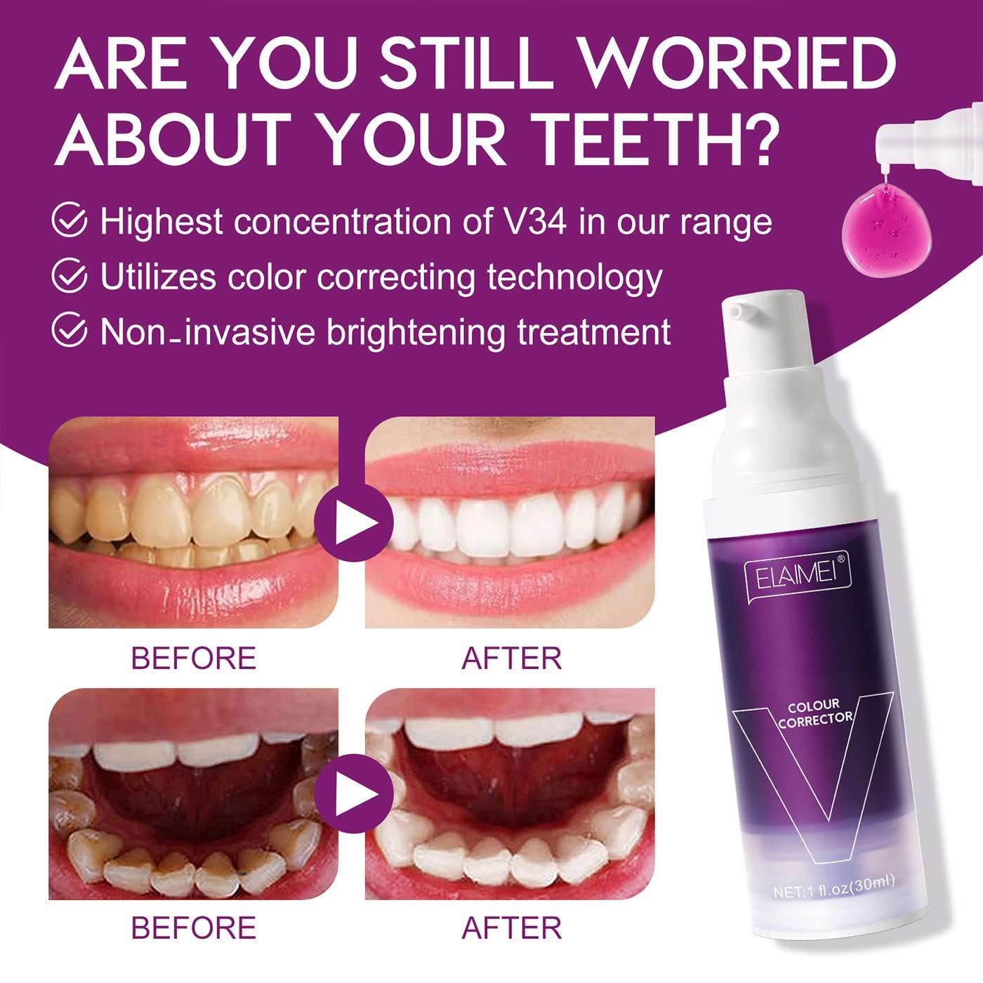 SayaFei Purple Toothpaste - Dental Color Corrector Serum in a Foam Formula to Remove Stains, (2PCS Blueberry)