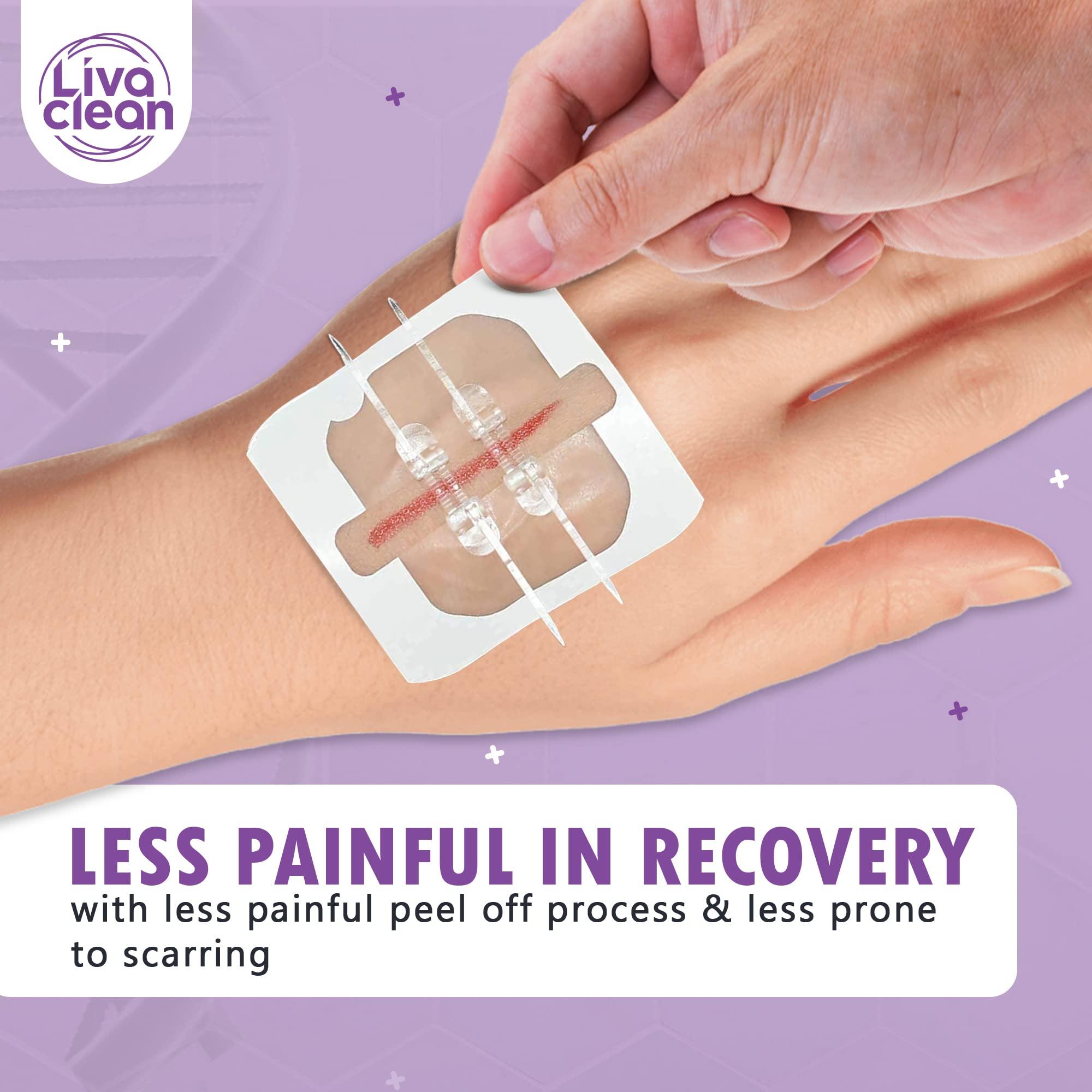 LivaClean (6 CT) 2.3 X 2.3 Butterfly Closures - Wound Closure Strips - Zip Stitch Wound Closure Butterfly Bandaids Adhesive Steri Strips Injury Closuring Glue Bandages Sutures