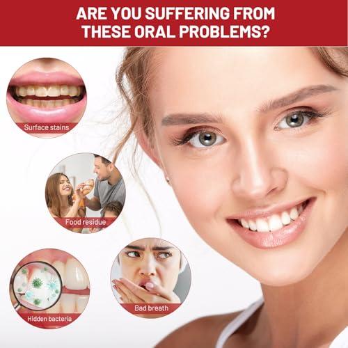 Mrryiio Sp10 Probiotic Toothpaste,Sp-10 Ultra Whitening Toothpaste,Probiotics Bright White Toothpaste,Sp-10 Probiotic Toothpaste,Sp10 Toothpaste,Fresh Breath,Deep Cleaning Care Toothpaste2Pcs