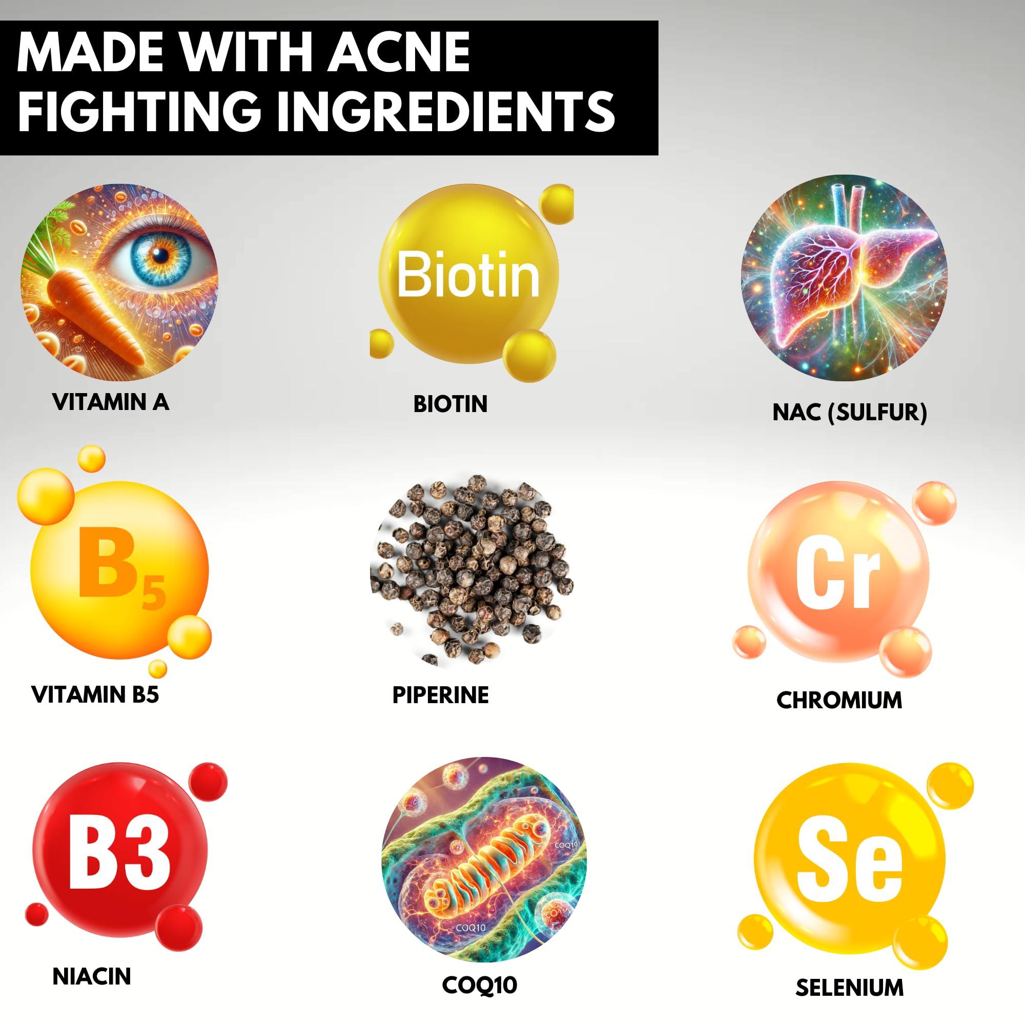 Acnetame Acnetame Acne Pills 30 Day- Supplements for Acne Vitamin Treatment- Tablets to Clear Oily Skin for Women, Men, Teens, and Adults