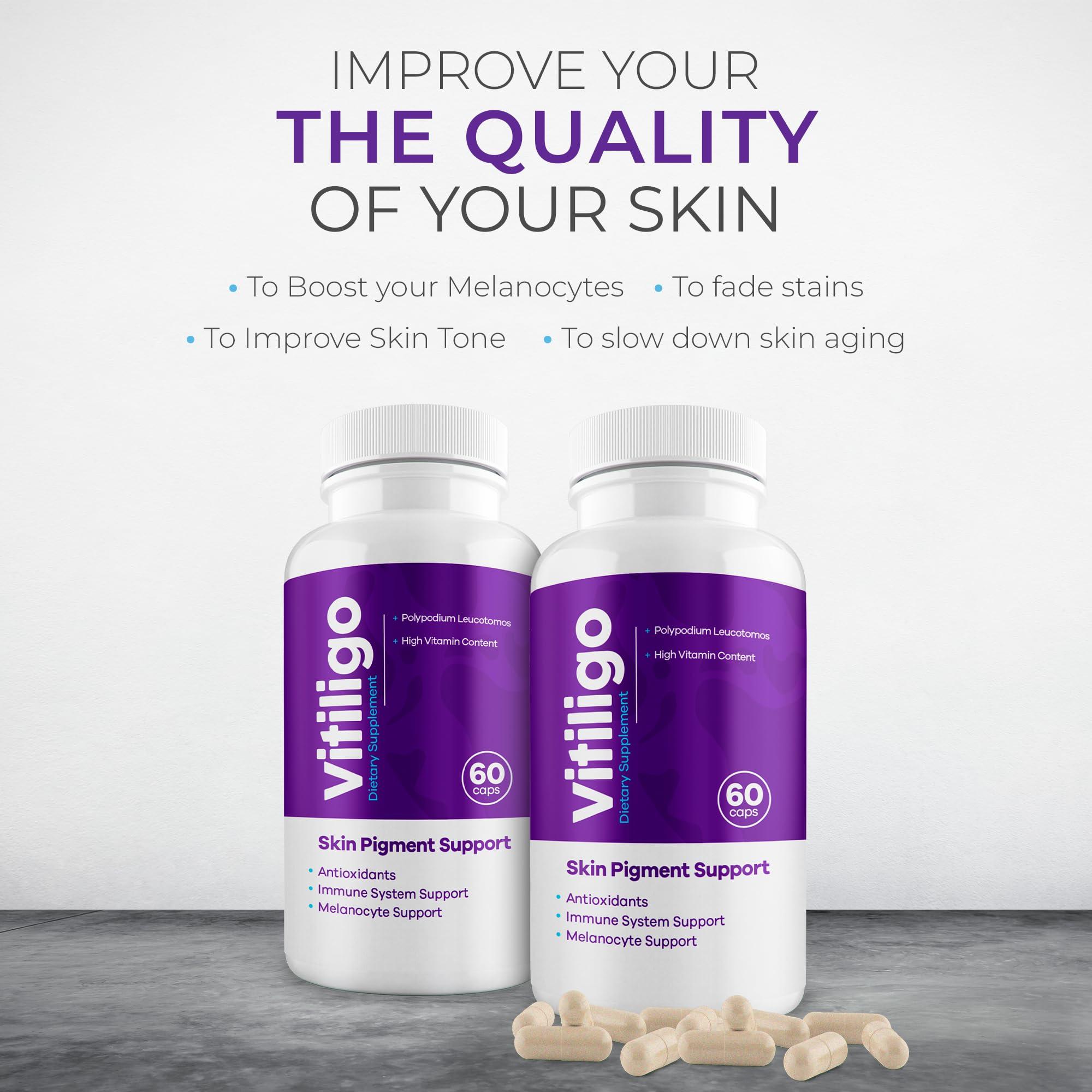 AURA VITAMINS AURA VITAMINS - Vitiligo Capsules 60 Count | 1 Month | Improve Skin Pigmentation Support and Reduce White Spots | Effective Vitiligo Supplement | Natural Solution for White Spots on Skin. (1)