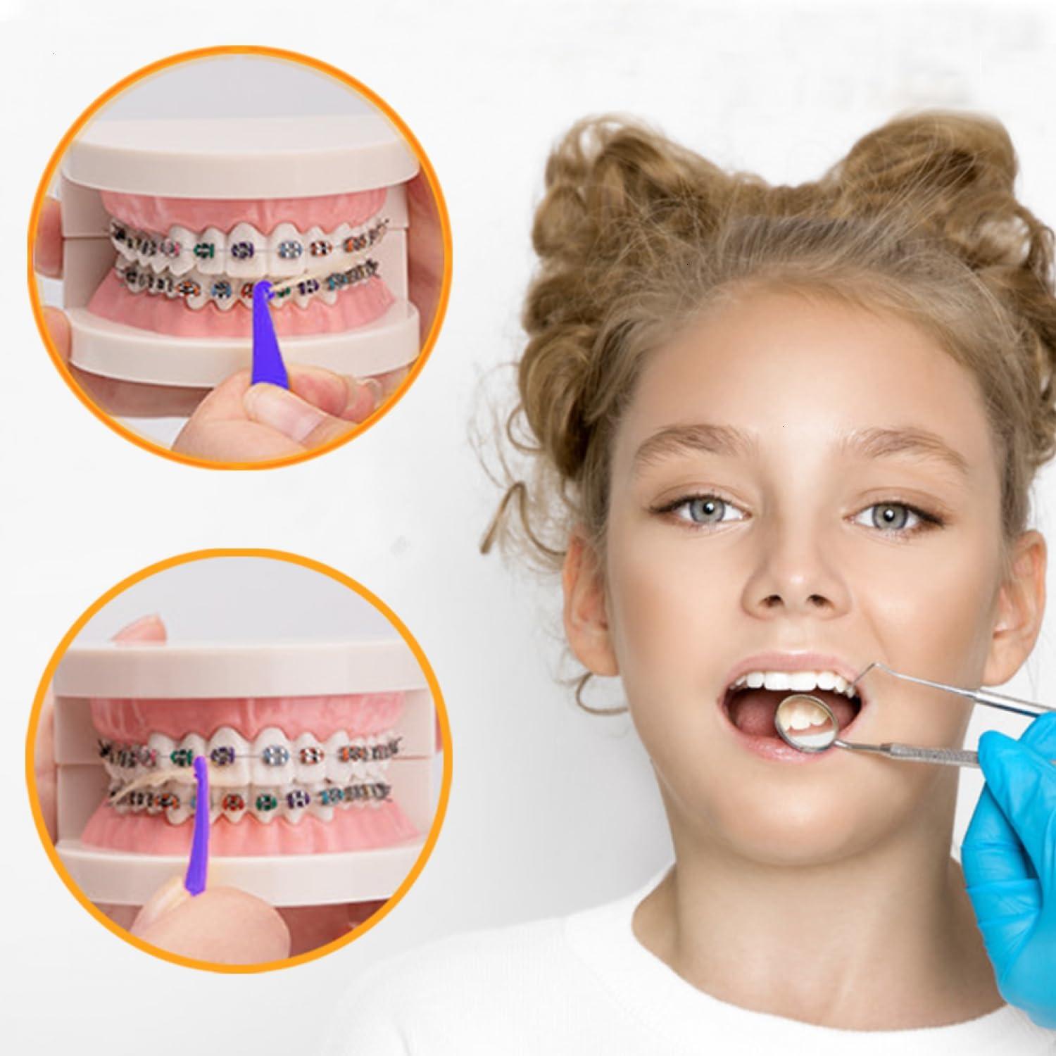 SenseYo SenseYo 200 Pcs Colorful Dental Elastic Braces Rubber Band Tool for Orthodontic Braces