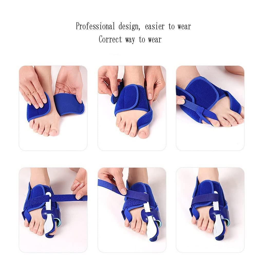DEAVER DEAVER Hallux Valgus Toe Corrector,Bunion Straightener,Men and Women Splint Reliefbunion Support Splitter Physiotherapy Painless Separator Pain Relief