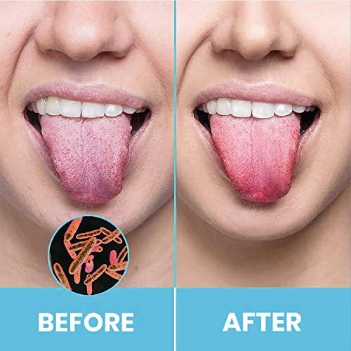 HOKIN Tongue Scraper for Adults by HOKIN (1Pc Oral Care Pack) Stainless Steel Tongue Cleaners Reduce Bad Breath 100% Metal Tough Scrapers Men and Women Hygiene (1 Count (Pack of 1) U Shaped, Silver)