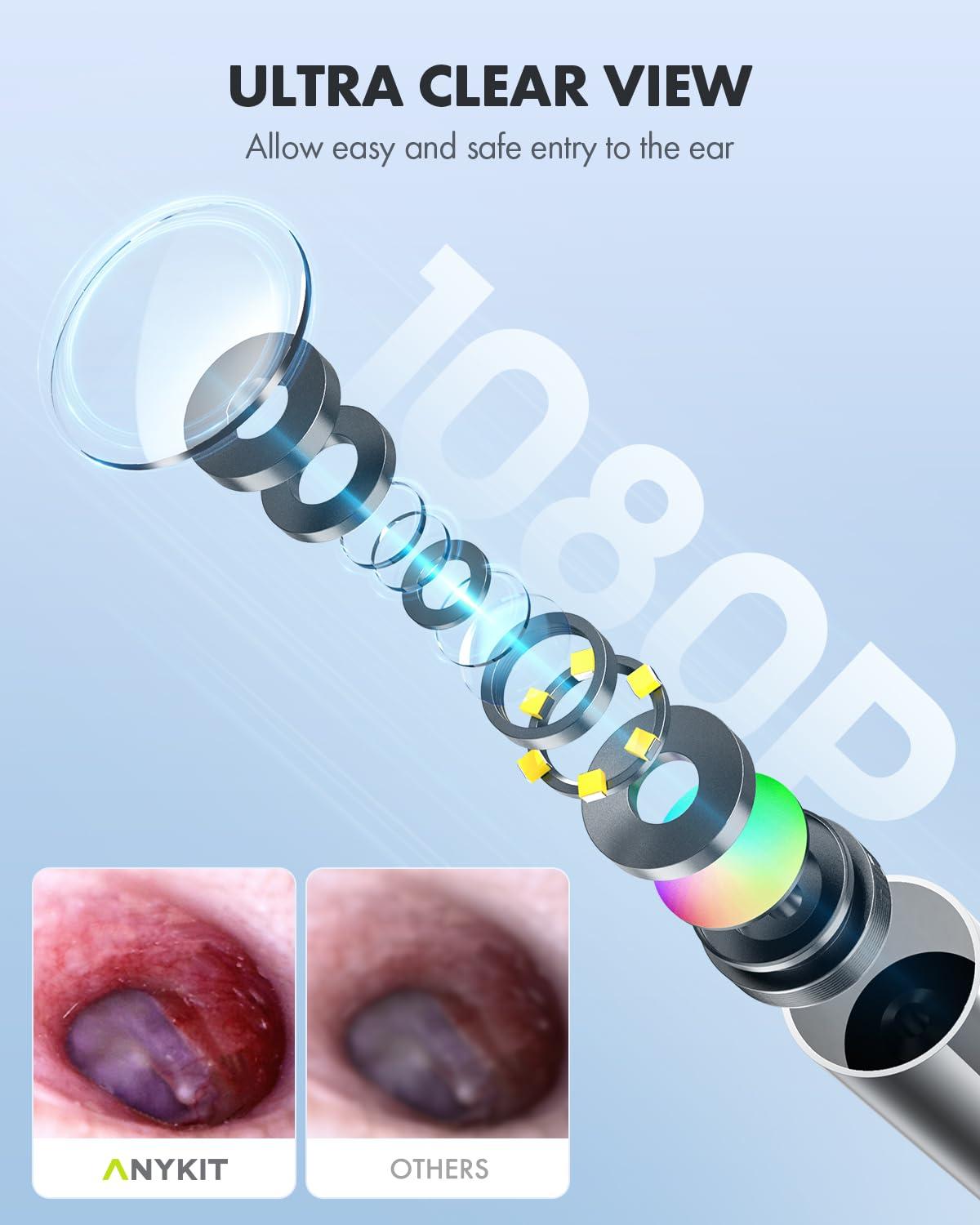 Anykit Anykit Digital Otoscope for Phone & Tablet, Ultra Clear View Ear Camera with Ear Wax Removal Tools, Video Ear Scope Otoscope with Light, Support Capture Photo & Record Videos