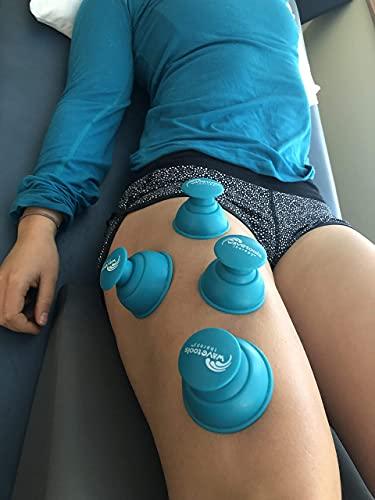 Wavetools Therapy \"Riptide\" Sport Cupping set of 4 push cups in case by Wavetools Therapy ideal for dynamic cupping, two suctions strengths