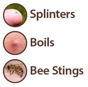 Globe Globe Ichthammol Ointment 20% (Drawing Salve) 1 OZ - Soothing Skin Relief, Treatment of Eczema, Acne, Boils, Splinters, Bee Stings - Maximum Strength