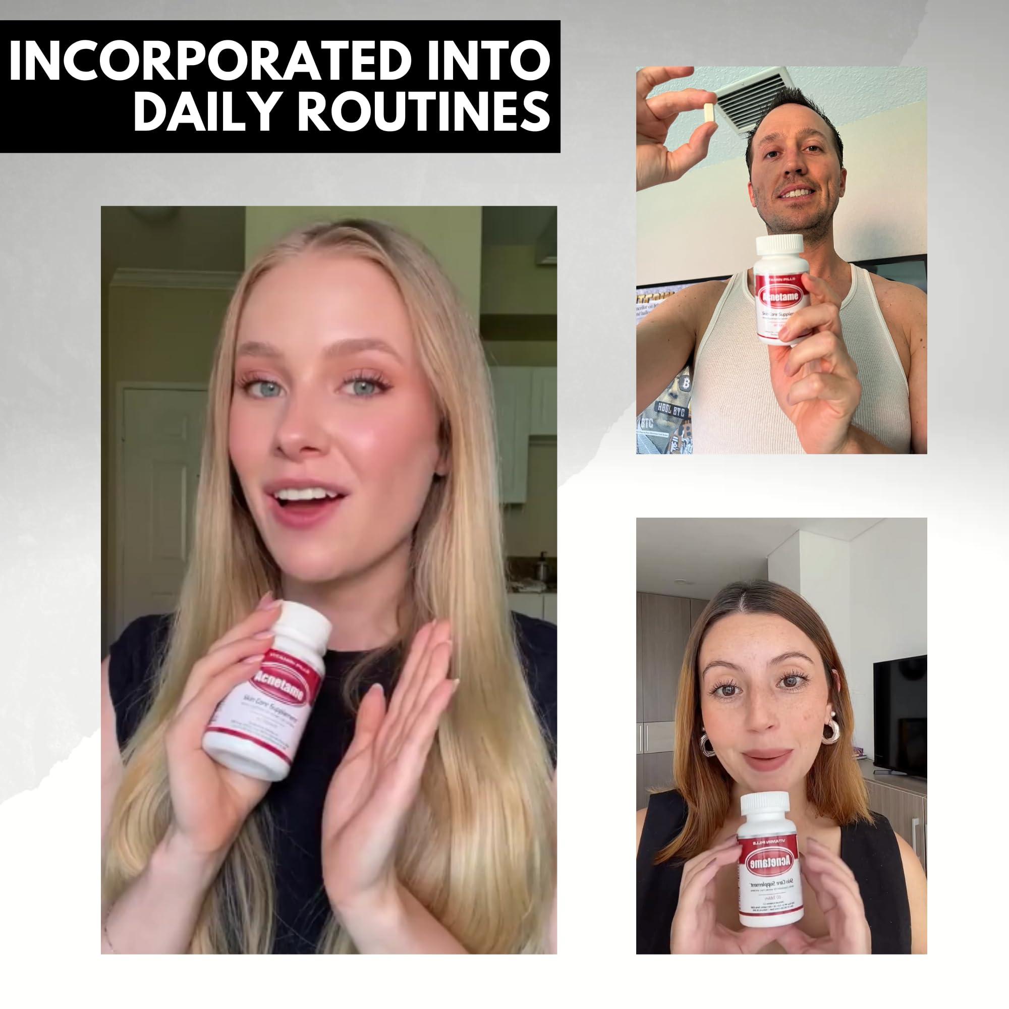 Acnetame Acnetame Acne Pills 30 Day- Supplements for Acne Vitamin Treatment- Tablets to Clear Oily Skin for Women, Men, Teens, and Adults