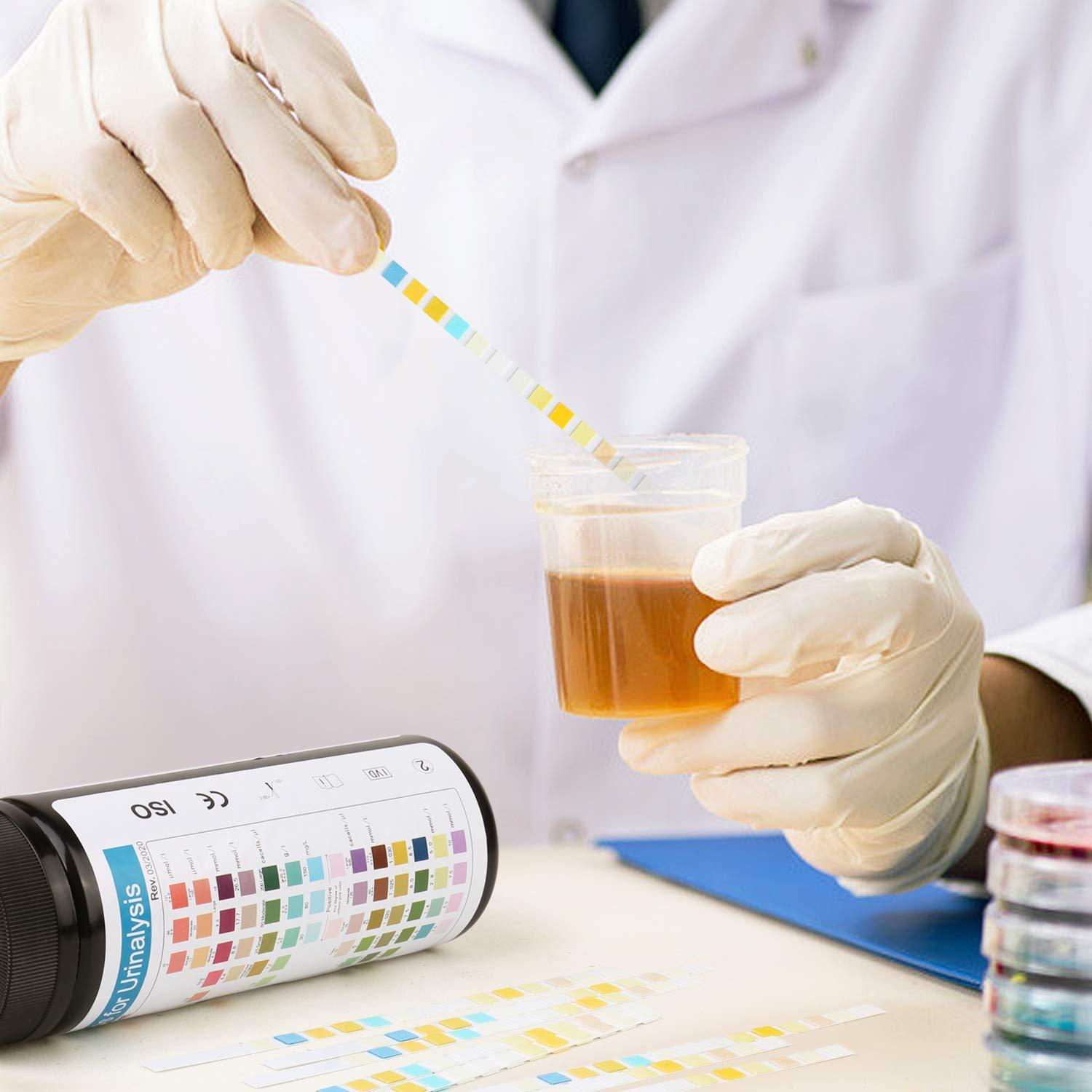 RPOMU Urine Test Strips 14 Parameters 100 Count