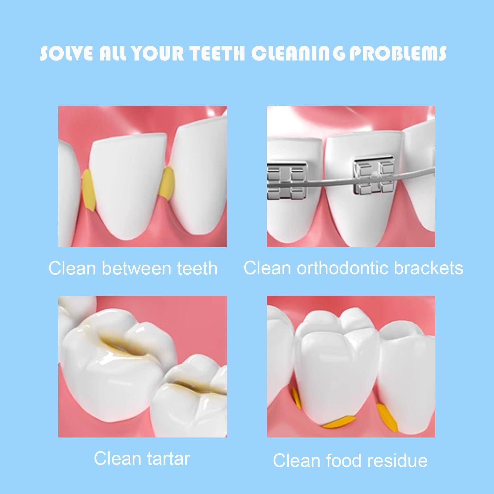 Maoerdental 50PCS L-Shaped Interdental Brushes Braces Toothbrush Short Handle,5 Different Sizes Dental Floss Brush Angled Interdental Toothpick